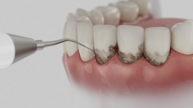 Reliable Dental Implants contractor in Fife, WA by Smile Center Dentistry